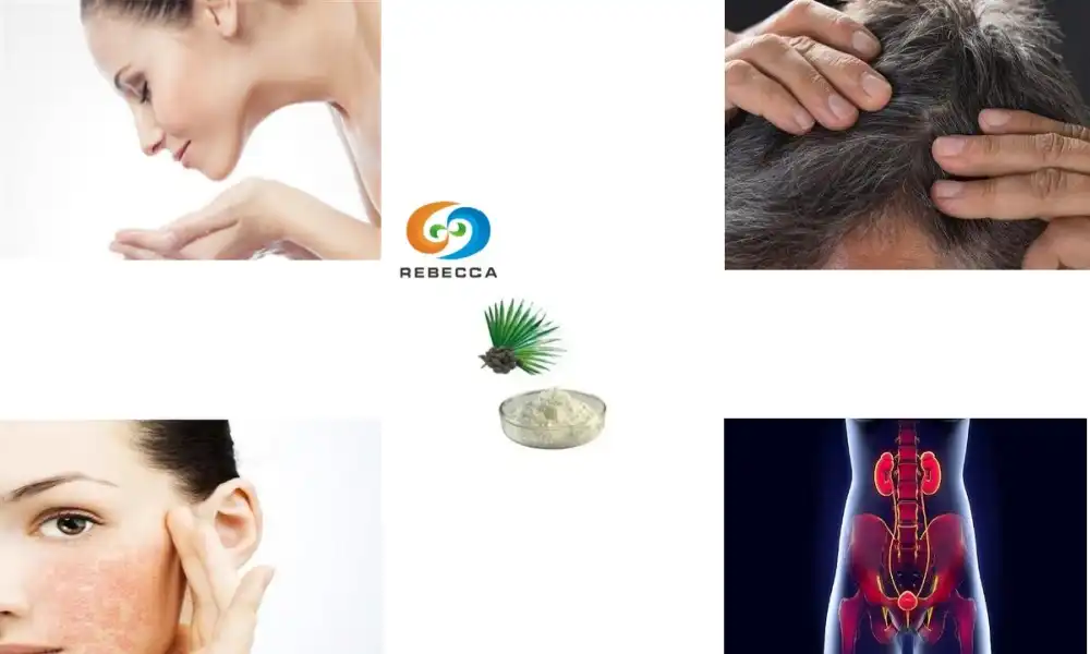 Top-Rated Saw Palmetto Extracts for Women in 2025 - Rebecca